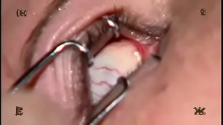 Insex – the Escort