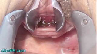 Onanere tissehul med tandbørste og kæde i urinrøret