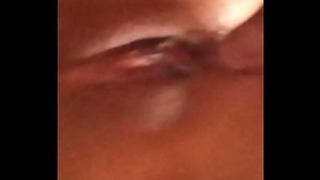 Anal Caser