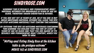 Mrplay Anal Fisting Sindy Rose At The Kitchen Table & She Prolapse Extreme