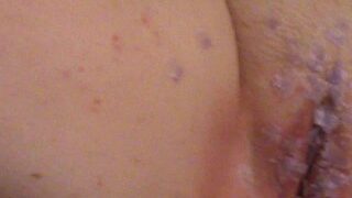 Putting Hot Candle Wax All Over Her Pussy ;