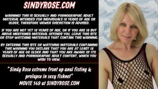 Sindy Rose Extreme Front Up Anal Fisting & Prolapse In Sexy Fishnet
