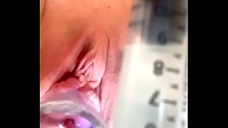 Cervix Dilated with Catheter and Masturbation